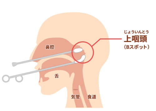 Bスポット療法との違い