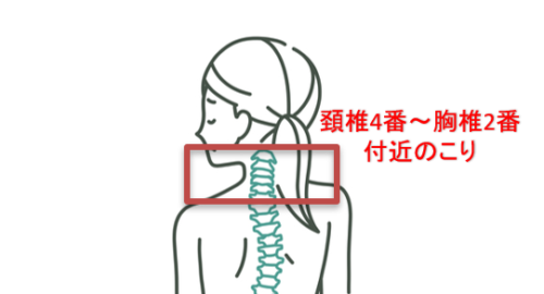 鍼灸院ひなたの施術